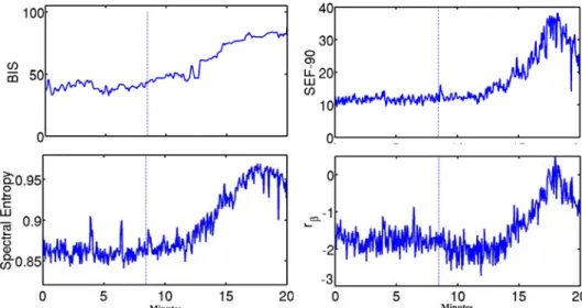 Fig. 7. Stockwell coherences between Fz and Fp1, C3, Cz, C4. Dashed lines indicate the  end of propofol injection