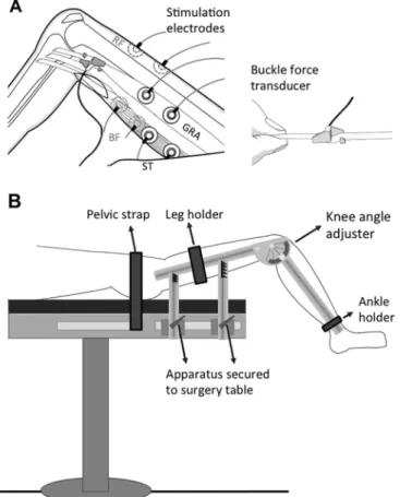 Fig. 2. Typical examples of force-time traces for spastic GRA muscle. Superimposed traces recorded for GRA muscle at the ﬁve knee angles studied are shown.