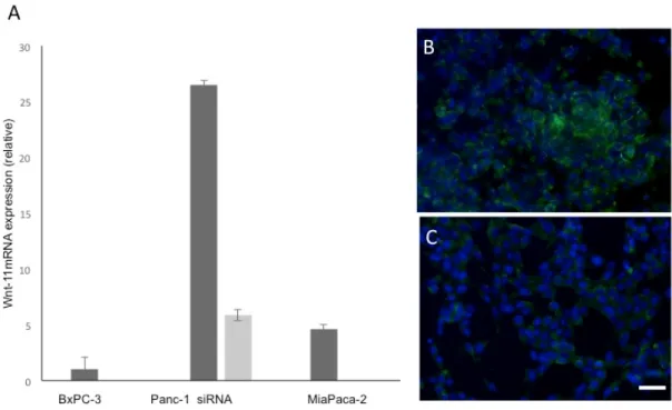 Figure 1. Wnt-11 mRNA relative expression profile in Bx-PC3, Panc-1 and MiaPaca-2 cells, and Wnt- Wnt-11 siRNA on Panc-1 cells