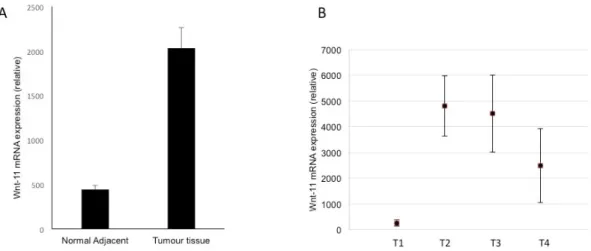 Figure 3. Functional evidence for Wnt-11-induced reduction of Matrigel invasion on Panc-1 cell lines