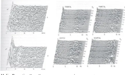 Şekil  4:Sol  tarafta    Helix  Pomatia’da    spontane  aktivitenin  frekans  spektrumu,  sağ  tarafta insanda saçlı deri üzerinden alınan güç spektrumları gösterilmektedir 