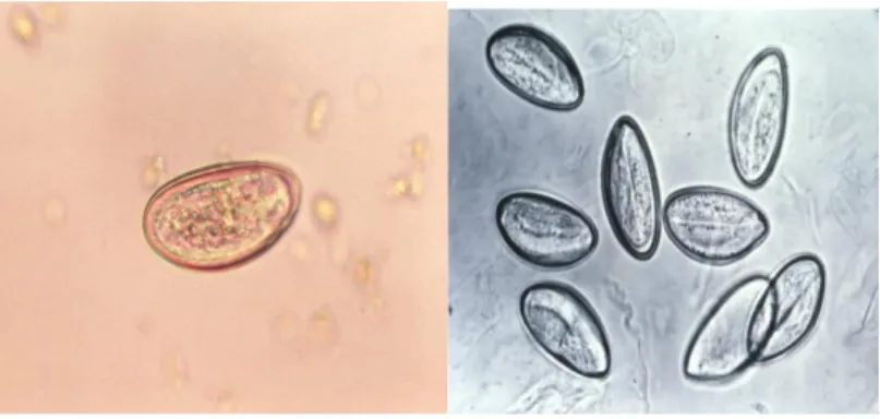 Şekil 1. Enterobius Vermicularis Yumurtalarının Mikroskobik Fotoğrafı [25] 