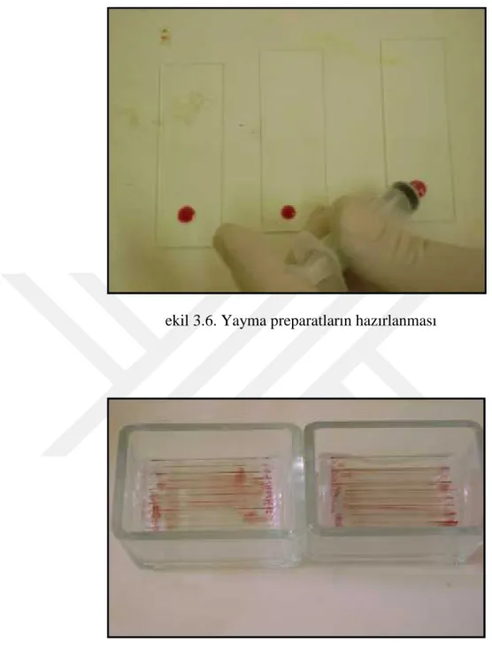 Şekil 3.6. Yayma preparatların hazırlanması