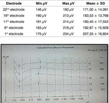 Figure 2. NRT result of a child who could not show wave V in ABR.