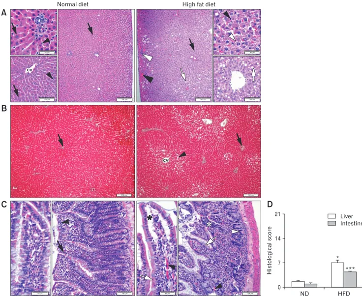 Figure 4.  Representative micrographs of the liver tissue stained with (A) H&amp;E (black arrow, hepatocyte with regular morphology; black ar- ar-rowhead, Kupffer cell; white arrow, fatty vacuoles in liver parenchyme; white arar-rowhead, hepatocyte with ba