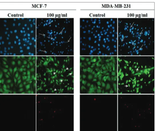 Table 3: Results of comet analysis in MCF-7 and MDA-231cell lines treated with Salvia kronenburgii extract, positive and  negative controls (mean±standard deviation)