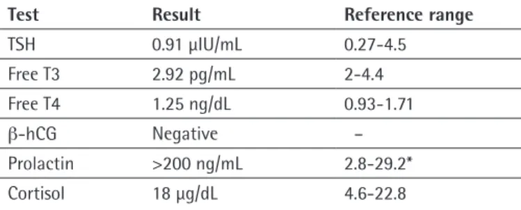 Figure 1. Brain magnetic resonance imaging of the patient: a) Demyelinating  plaques on axial image; b)Sagittal section image of the pituitary gland and  hypothalamic region