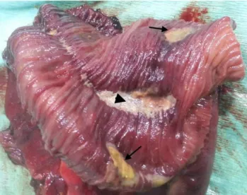 Figure 2: Intraoperative image of the small intestines. Necrotic area on the jejunum  (black arrow) 