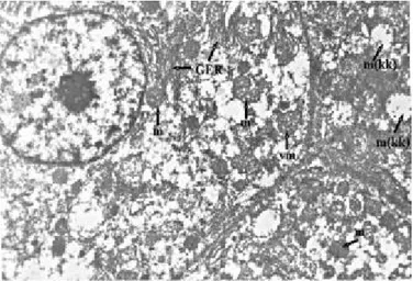 Fig. 3: GrupII: m=mitochondria, L=Lipid granules, Uranyl acetate- acetate-Lead citrate x9000.