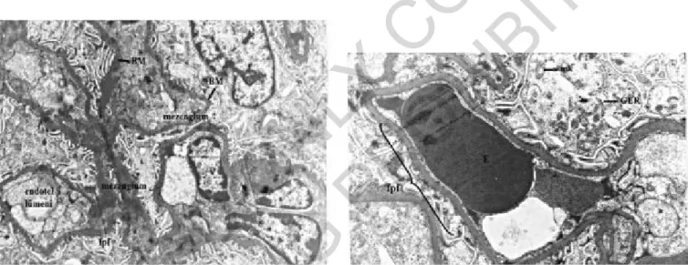 Fig. 13: Grup III: BM= Basement membrane, fpf= foot process fusion, Uranyl acetate-lead citrate x9000.