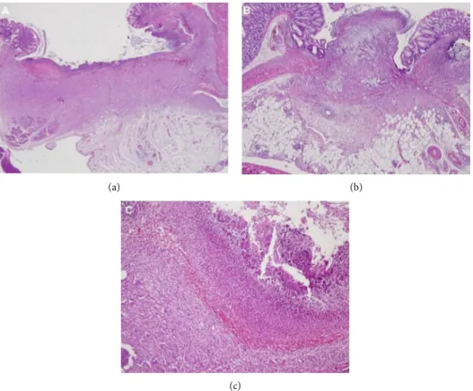 Figure 2: Wound healing area involving (a) marked PMN cell and MN cell inﬁltration accompanied with mild necrosis, mild edema, and marked granulation tissue with no submucosal or mucosal muscle bridging, H&amp;E ×20 (control group); (b) almost no necrosis 