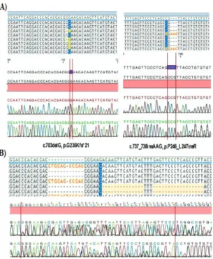 Figure 1. Novel variants including insertions and deletions were  detected in two T-ALL cases.