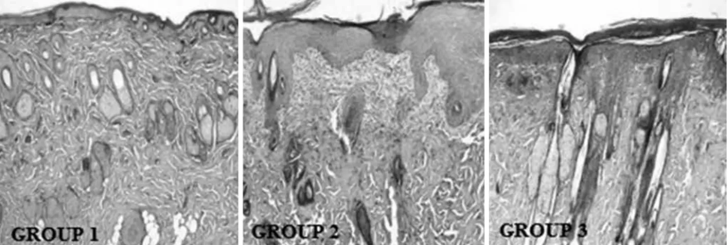 Figure 8. Microscopic images of wound area belonging to Group 1, Group 2 and Group 3 on Day 14 (Masson’s trichrome stain 