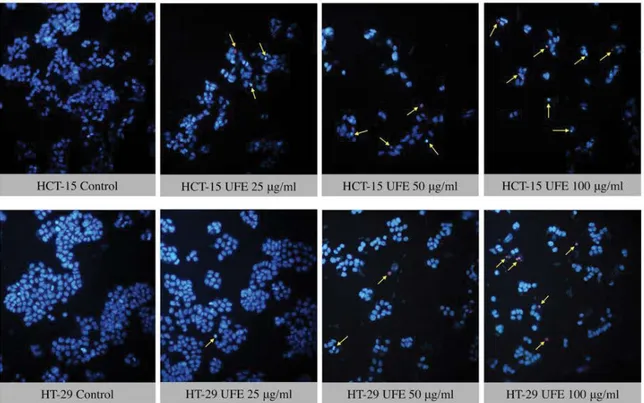 Fig. 5: Fluorescence imaging using Hoechst 33342 nucleic acid stain in HCT-15 and HT-29 cells 