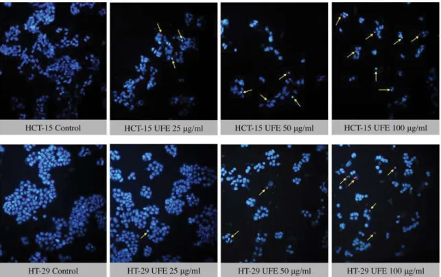 Fig. 5: Fluorescence imaging using Hoechst 33342 nucleic acid stain in HCT-15 and HT-29 cells 