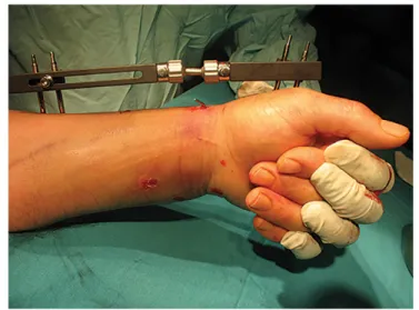 Figure 1. Postoperative evaluation of optimal reduction and distraction.