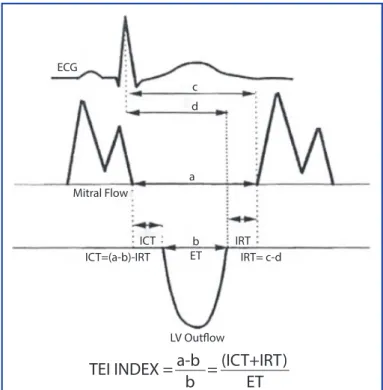 Şekil 1. Tei indeksinin hesaplanması.ECGETICTICT=(a-b)-IRT LV OutflowMitral Flow IRT= c-dIRTcdab