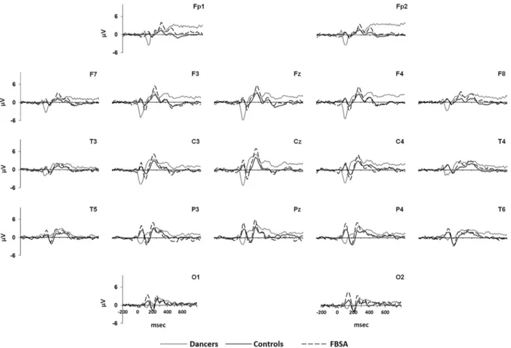 Fig. 4 Grand averages ERPs to visual spatial non-target stimuli of dancers (dotted line), FBSA (broken line) and controls (solid line)