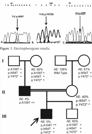 Figure 1. Electropherogram results. 