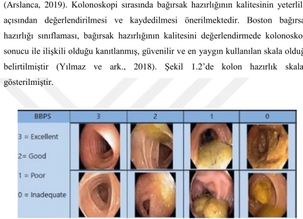 Şekil 1.2. Kolon Hazırlık Skalası 