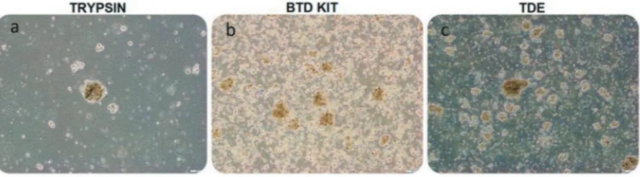 Figure 1. Glial tumor stem cells, isolated with trypsin, BTD Kit and TDE from equal amount of glioblastoma specimen, seeded 1 ×  10 6  cells into each flask were visualized by phase-contrast microscopy on day 4, passage 0 in suspension culture (bars: a-b:1