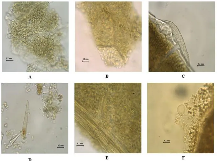 Şekil 13. Aloysia citriodora toz drog örneklerinin mikroskobik özellikleri. A. Üst epiderma ve palizat parenkiması, B