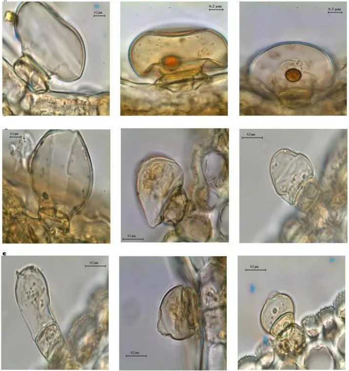 Şekil 9. Aloysia citriodora yapraklarında görülen salgı tüyü tipleri  3.2.1.2. Yaprak Üst Epiderma Yüzeyel Kesiti 