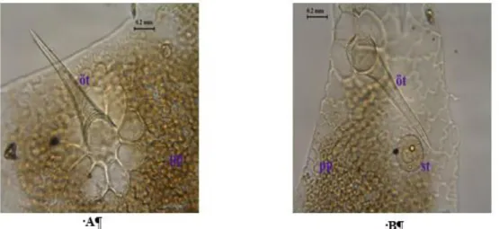 Şekil 10. Aloysia citriodora yaprak üst epiderma yüzeysel kesiti A. Üst epiderma, palizat parenkiması, örtü tüyü, B