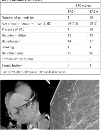 Figure 2. Moderate calcification in the left anterior descending  coronary artery of a 74-year-old woman with BAC score 9