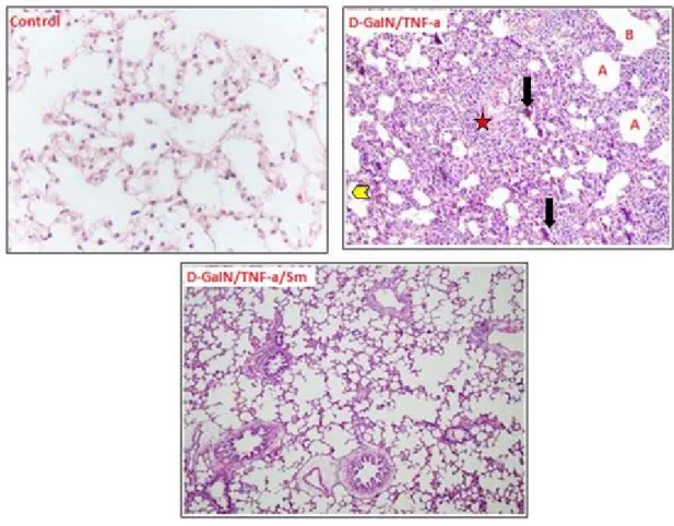 Figure 1. Lung structure of the control mice, D-GaIN/TNF-a administered mice and D-GaIN/TNF-a/Sm  treated mice in sections stained with HE: A alveol; Bronchlole; B Oedema; Arrowheads, swelling 