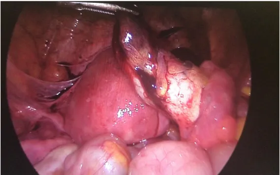 Figure 2 shown that the GS was exracted from OT with ease. 