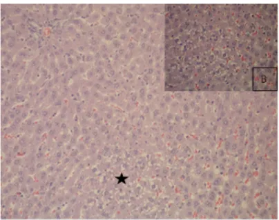 Figure 3: Microvesicular fatty change observed in the liver of Ethanol group rats (asterisk), (H&amp;E, X200),  B, Magnified region, indicated by an asterisk (H&amp;E, X400) 