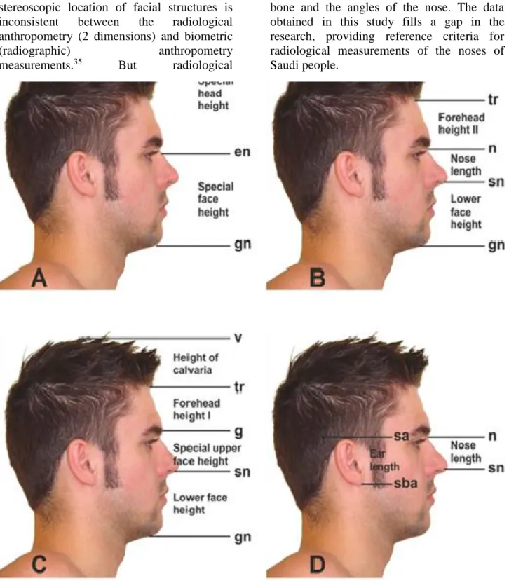 Figure  1.  Vertical  measurements;  A;  special  head  height  [vertex-endocanthion  (v-en)],  special  face  heihgt  height  [endocanthion-gnathion (en-gn)], B; forehead height II [(trichion-nasion (tr-n)], nose length [nasion-subnasale (n-sn)],  lower  