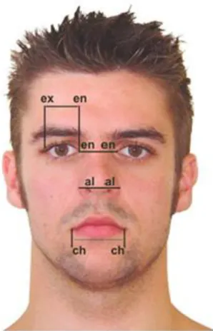 Figure  2.  Horizontal  measurements:  right  eye  fissure  length  [exocanthion-endocantion  (ex-en)],  intercanthal  distance  [endocanthion-endocanthion  (en-en)],  nose  width  [alare-alare  (al-al)],  mouth  width   [cheilion-cheilion (ch-ch) 