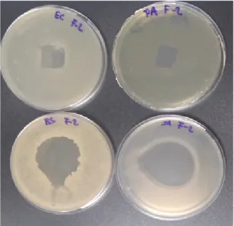 Figure 2: Antibacterial activity of S1-S5 samples against P.  aeruginosa.
