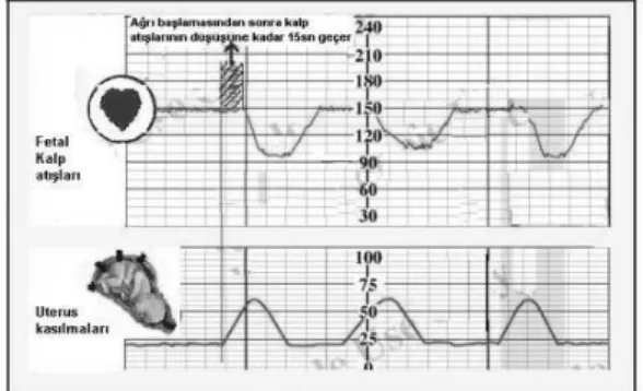 Şekil 2. Farklı üreticilere ait fetal doppler cihazları [1],[2],[3]