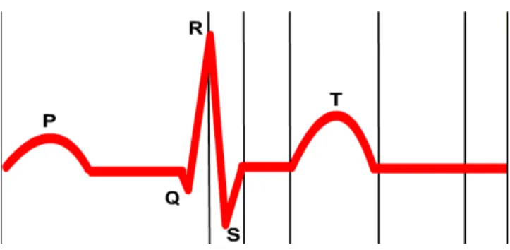 Şekil 1. EKG işareti kompleksi  