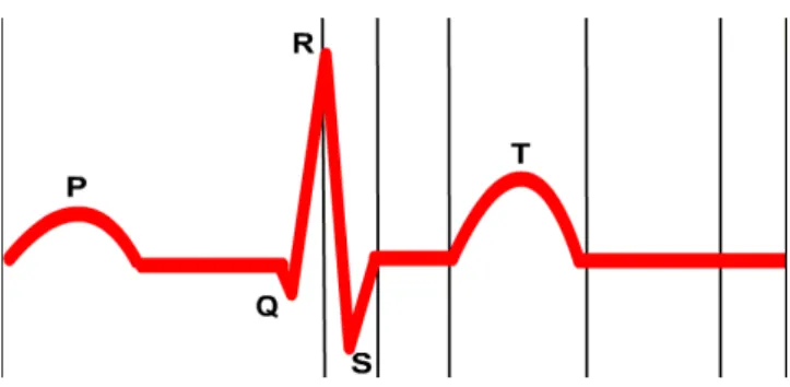 Şekil 1. EKG işareti kompleksi  