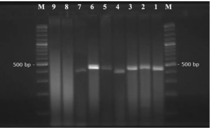 Fig. 3 Reverse line blot assay of the PCR products generated by amplification of genomic DNA from sheep and goat samples infected with Theileria and Babesia species, and from negative and positive samples as template