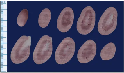 Fig 1. An example of consecutively sectioned kidney with slicer