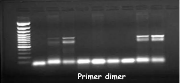 Şekil  2.  Farklı  MgCl 2   konsantrasyonlarının  PCR ürünlerine  etkisi