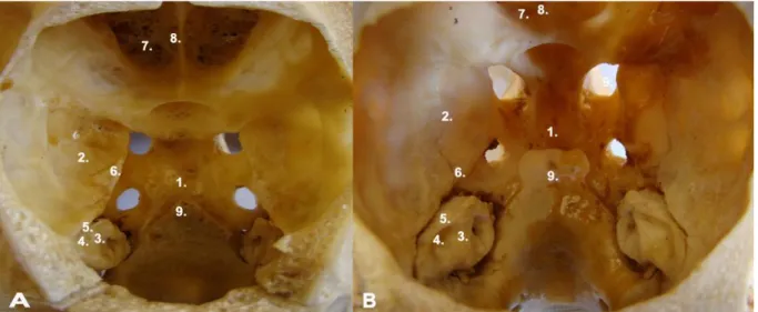 Şekil  3A.  Akkaraman  koyununa  (Ovis  aries)  ait  kafa  kemiğinin  cavum  cranii  yüzü  ve  morfolojik  farklılıklar  (♀)