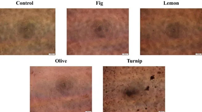 Figure 1. MCF-7 cells treated with 100 µg/mL protein containing fig, lemon, olive, and turnip exosomes for 72 h  were photographed by an inverted microscope