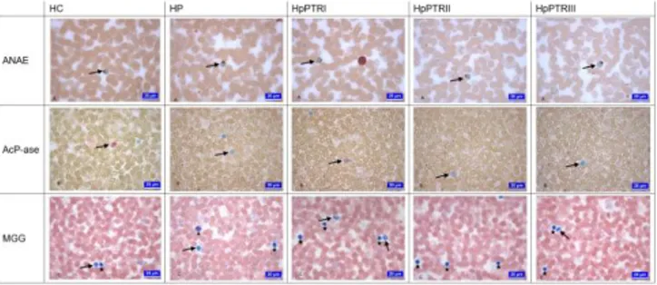 Figure  1.  Images  of  PB  smear  from  the  groups.  A:  ANAE-  positive  T  lymphocytes