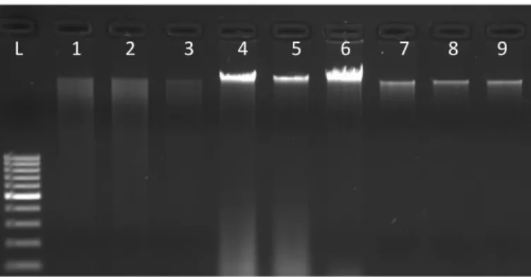 Figure 1. Agarose gel electrophoresis of DNA extracted using different methods of extraction