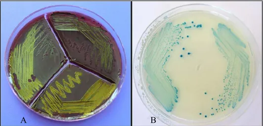 Şekil 3.1.A) EMB Agar besiyerinde E. coli kolonilerinin genel görünümü B) TBX Agar besiyerinde E