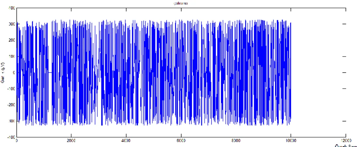 Şekil 4.4  10 numaralı normal deneğin, çalışma durumunda alınan 1 sn’ lik EMG sinyali 