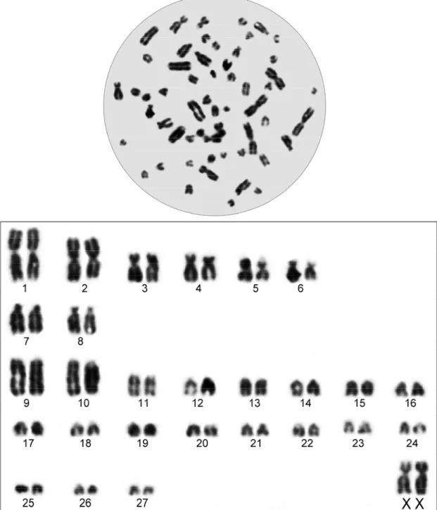 Şekil 4.5. Manisa ili Alaşehir ilçesindeki 2n=56 kromozomlu dişi bir örneğin metafaz plağı ve standart  karyotipi