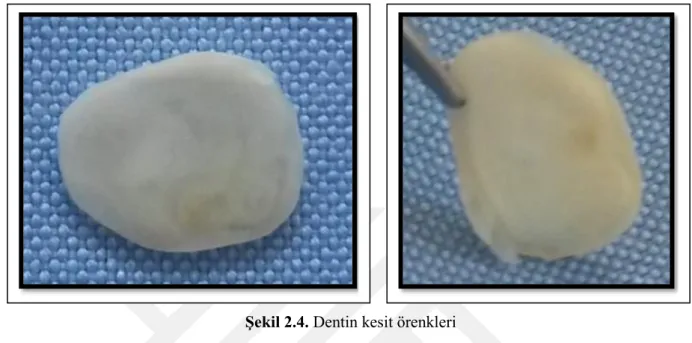 Şekil 2.4. Dentin kesit örenkleri 