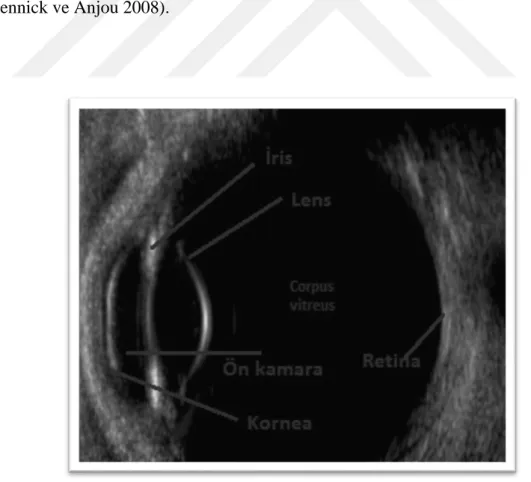 Şekil 1.15: Gözün Ultrasonografik görüntüsü 